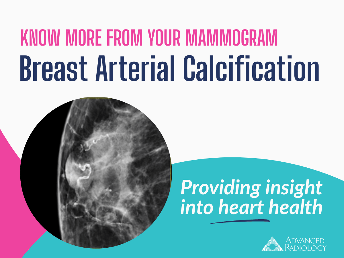 Reporting for Breast Arterial Calcifications