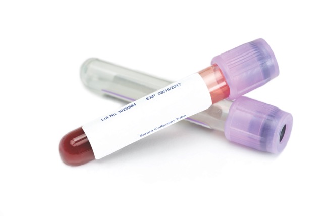 MRI Contrast Agents | Advanced Radiology Maryland
